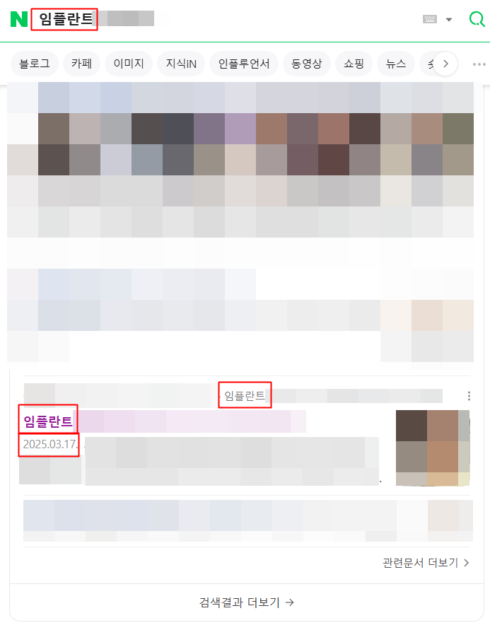 임플란트 주요 관련 키워드 상위노출 장면