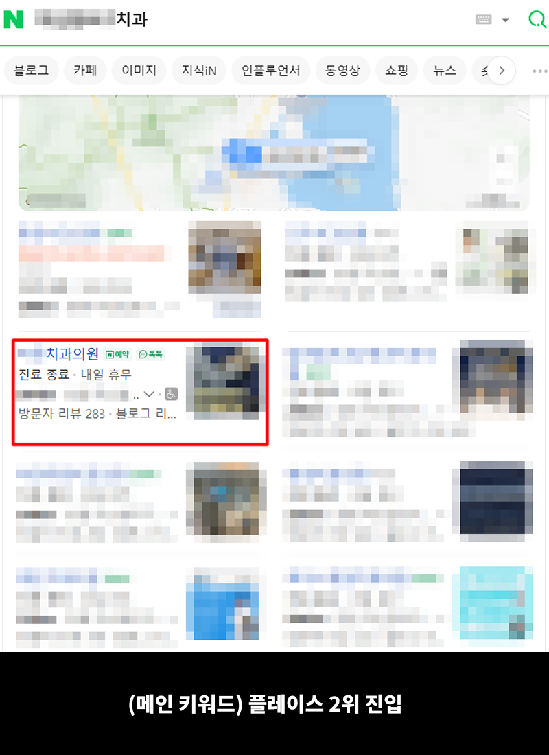 치과-고객-성공사례2