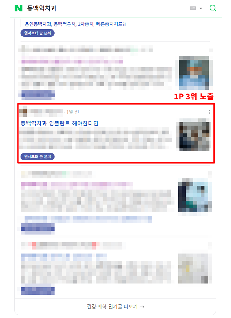 치과-블로그-상위노출3