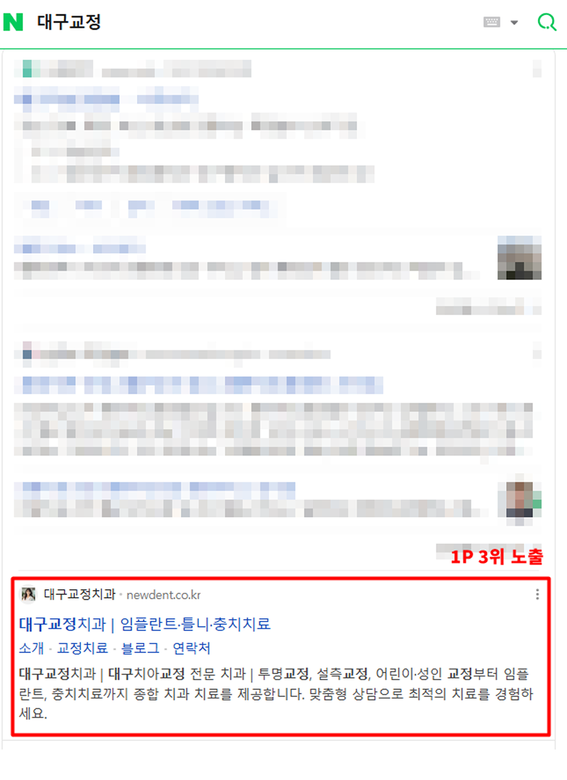 치과-사이트-상위노출1