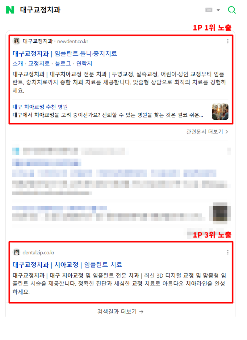 치과-사이트-상위노출3