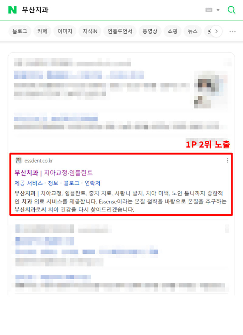 치과-사이트-상위노출4